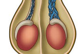 معجون واریکوسل وارداتی/طب سنتی هندی ایرانی با ده گرم ژل رویال---یک کیلو