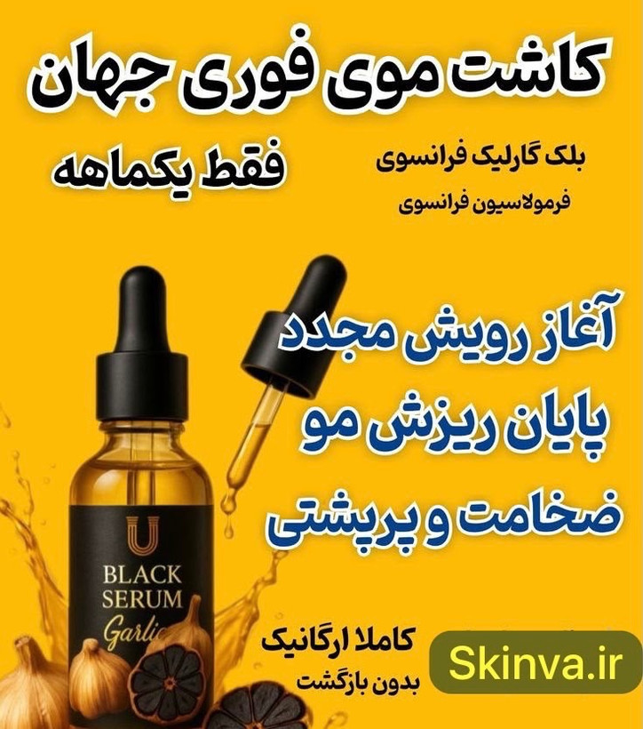 سرم سیر سیاه برند لاکچری کوین برای پرپشتی ریش و سیبیل تضمینی